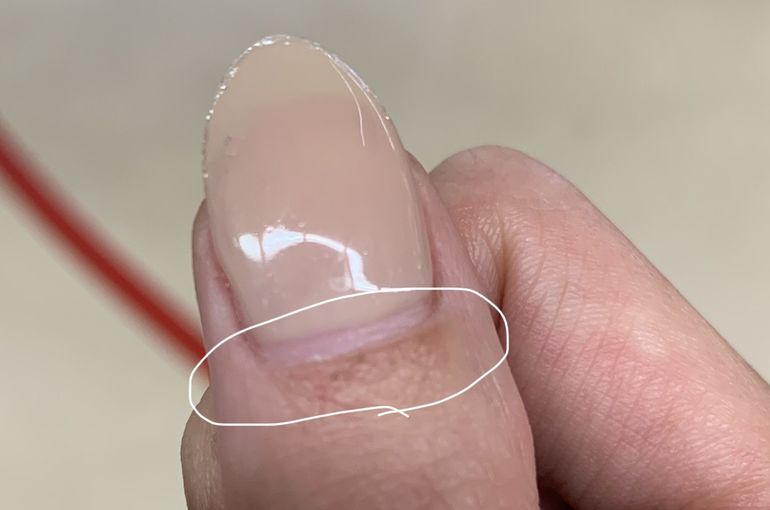 70以上 ジェル ネイル アレルギー 対応 2978 ジェル ネイル アレルギー 対応 サロン